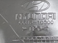 защита арок передняя правая (подкрылок) Hyundai Matrix 1 поколение [2-й рестайлинг] 2009, 1.6 л., МКПП, минивэн, 8681217000 - фото №4