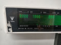подушка крепления двигателя Rover 400 Series 2 поколение 1998, 1.6 л., бензин, МКПП, зеленый, хетчбэк 5 дв. - фото №7