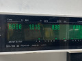 подушка крепления двигателя Daewoo Nubira J100 1998, 1.6 л., i, бензин, МКПП, хетчбэк 5 дв., передний привод, A16DMS - фото №5