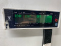 фара левая Daewoo Nexia 1 поколение 2000, 1.5 л., G15MF, бензин, МКПП, красныц, хетчбэк 5 дв., передний привод - фото №10